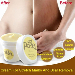 50g Safety Pregnancy Repairing Cream Stretch Marks Scar Obesity Maternity Skin Body Removal Repair Cream