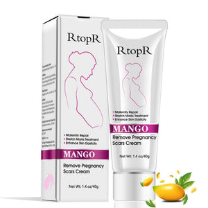 Remove Pregnancy Scars Acne Cream Stretch Marks Treatment Maternity Repair Anti-Aging Anti Winkles Firming Body Cream