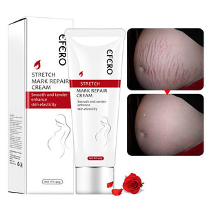 Stretch Mark Repair Cream Remover Removal Scar Body Skin Care for Pregnancy Women NShopping